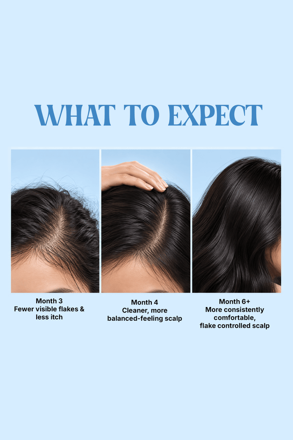 DANDRUFF & ITCH RELIEF - SHAMPOO - Kiwai