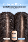 DANDRUFF & ITCH RELIEF - SHAMPOO - Kiwai