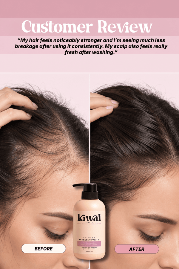 INTENSE GROWTH - SHAMPOO - Kiwai